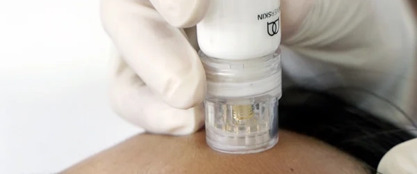 Microneedling-0623